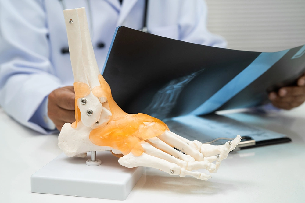 Doctor with foot and ankle joint bone model during consultation for ankle replacement and ankle fusion assessment.