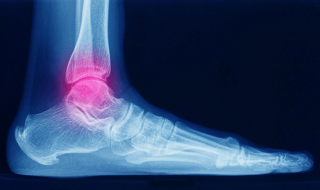An imaging test showing a patient’s ankle pain