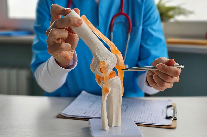 Doctor holding a model of the human knee joint showing bones and cartilage structure.
