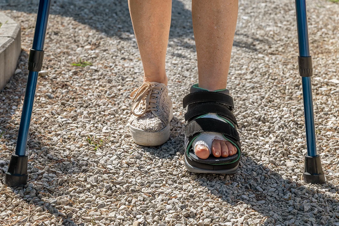 Patient using crutches after foot surgery